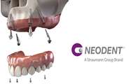 All About Neodent Implants