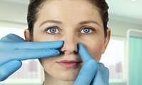 Comprehensive Article on Revision Rhinoplasty