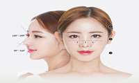 Comprehensive Article on Natural Nose Surgery 