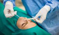 Comprehensive Article on Non-Anesthesia Nose Surgery