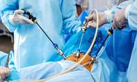 Advanced Laparoscopic Surgery Types at Firouzabadi Hospital