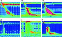 Manometry: A Vital Tool in Diagnosing Digestive Disorders at Firouzabadi Hospital